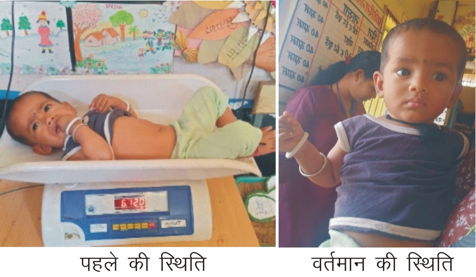 गंभीर तीव्र कुपोषण से सामान्य पोषण श्रेणी में पहुंची याक्षी …
